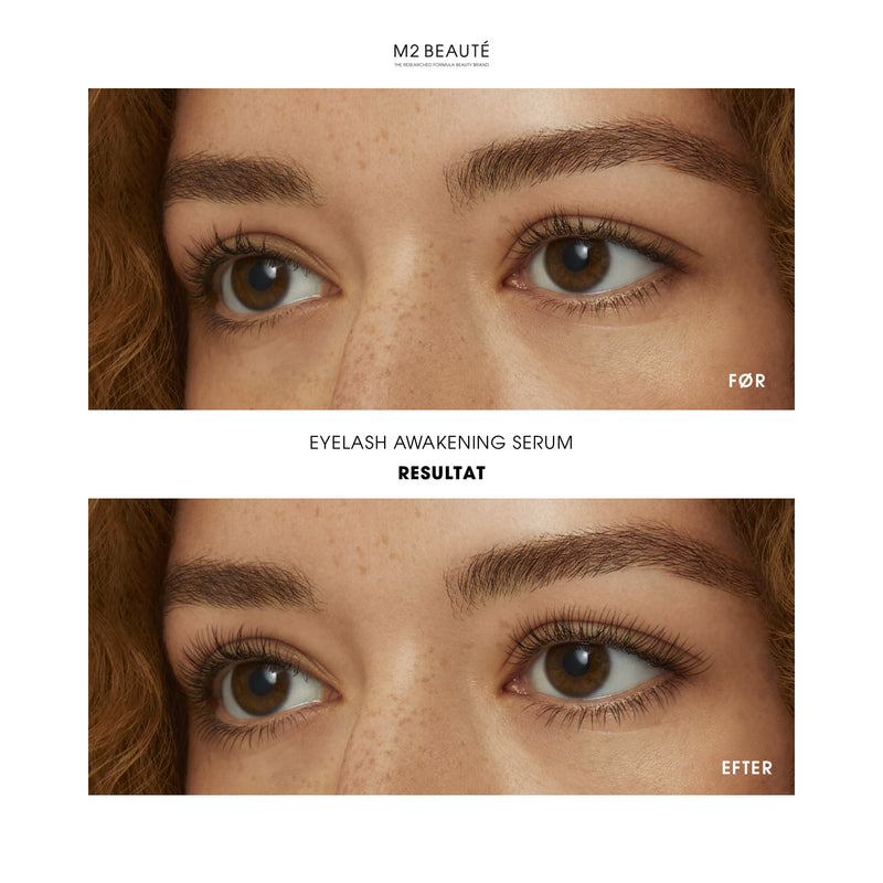 Eyelash Awakening Serum